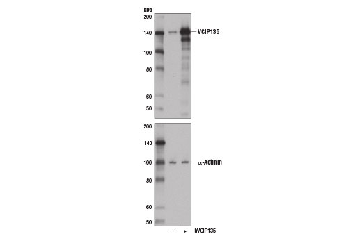 Western Blotting Image 2: VCIP135 Antibody