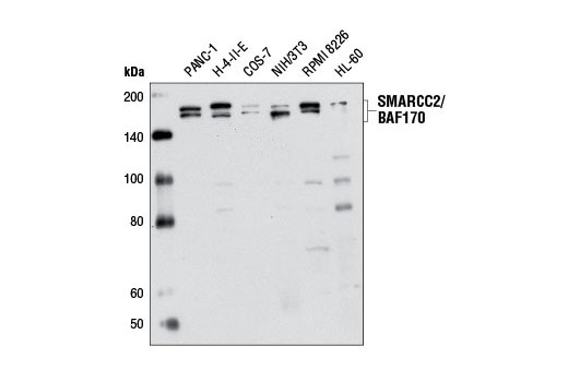 Western Blotting Image 1: SMARCC2/BAF170 Antibody