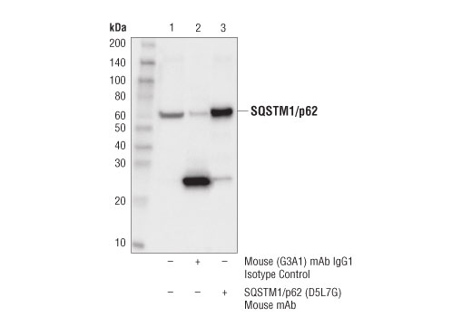 Immunoprecipitation Image 1: SQSTM1/p62 (D5L7G) Mouse mAb