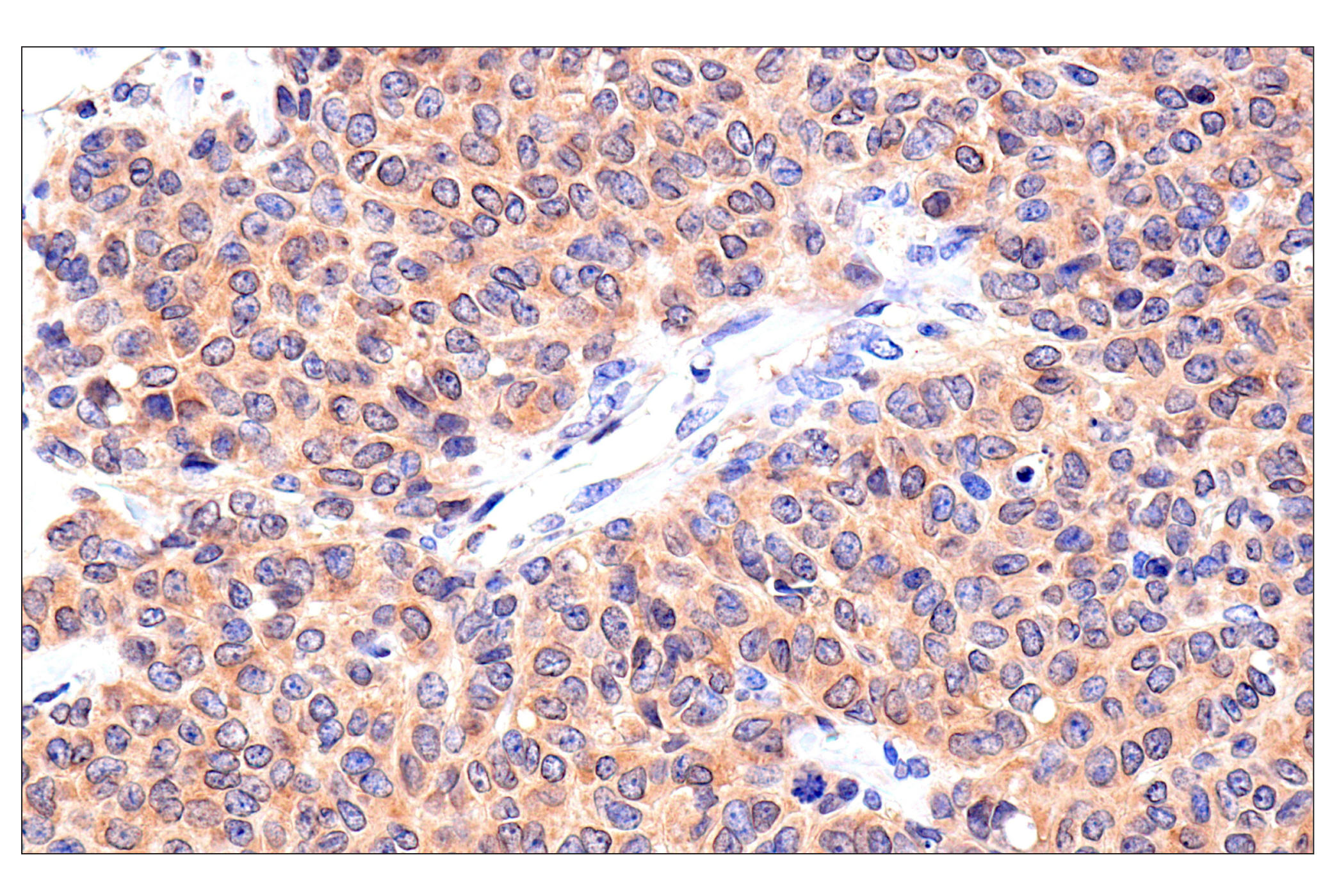 Immunohistochemistry Image 2: Caspase-8 (F5K9P) Rabbit mAb