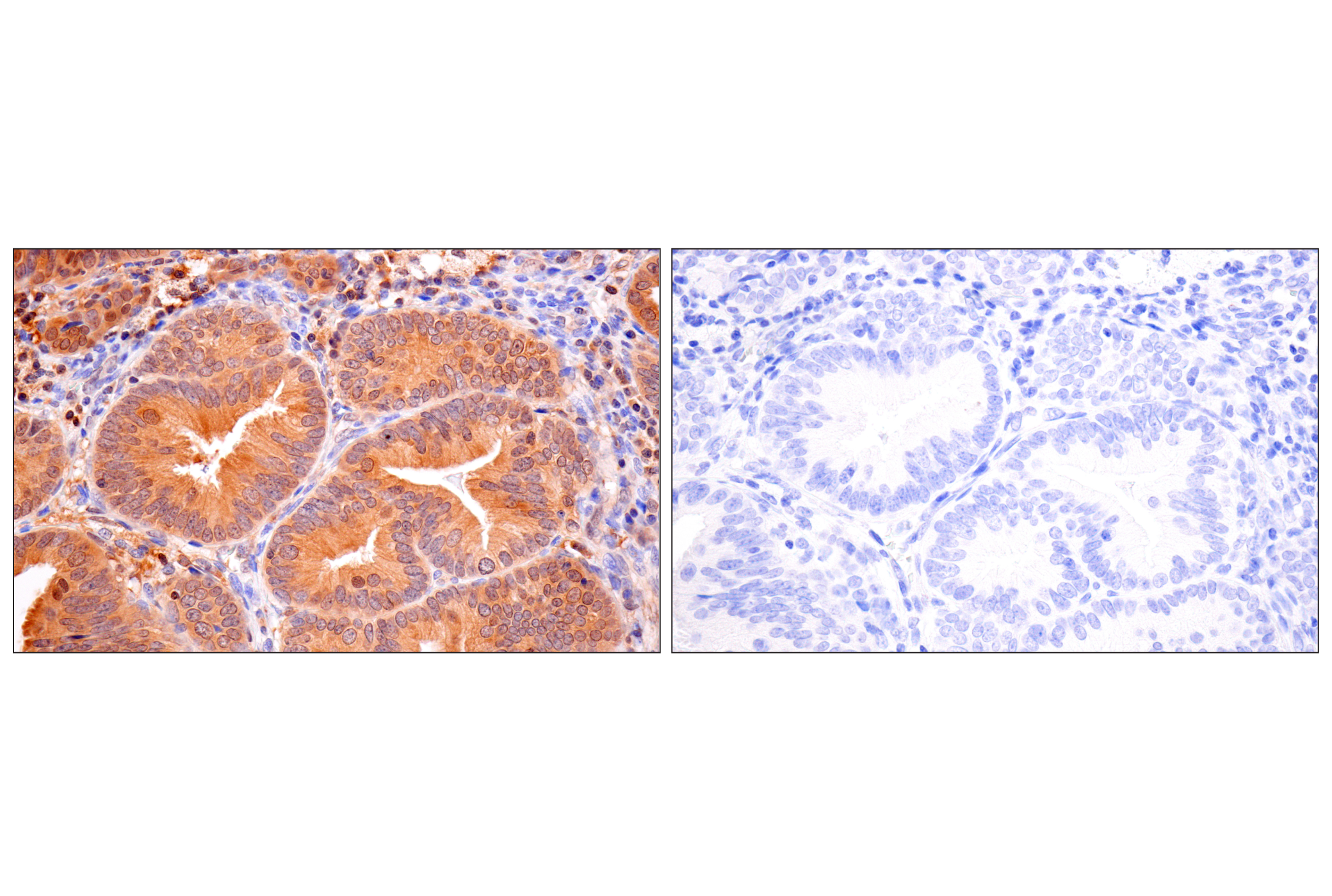 Immunohistochemistry Image 10: Caspase-8 (F5K9P) Rabbit mAb