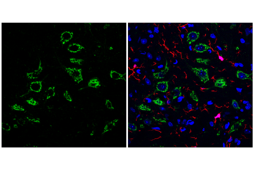 Immunofluorescence Image 3: Osteopontin/SPP1 (E9Z1D) Rabbit mAb