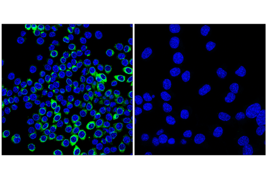 Immunofluorescence Image 4: Osteopontin/SPP1 (E9Z1D) Rabbit mAb
