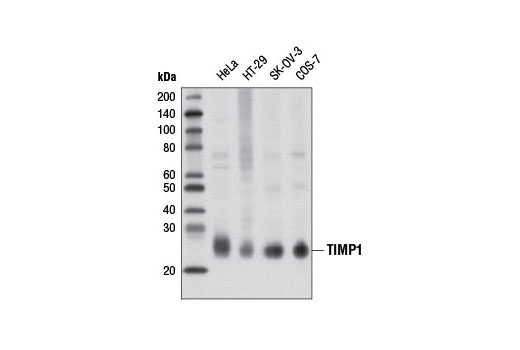  Image 10: Matrix Remodeling Antibody Sampler Kit