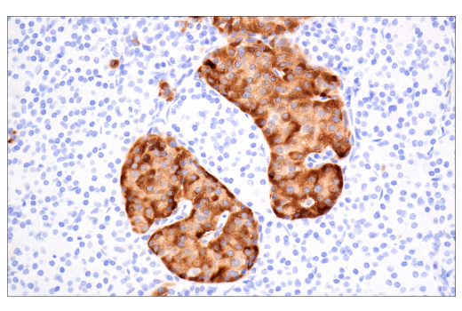 Immunohistochemistry Image 5: TIMP1 (D10E6) Rabbit mAb