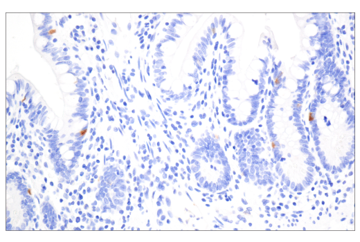 Immunohistochemistry Image 6: TIMP1 (D10E6) Rabbit mAb