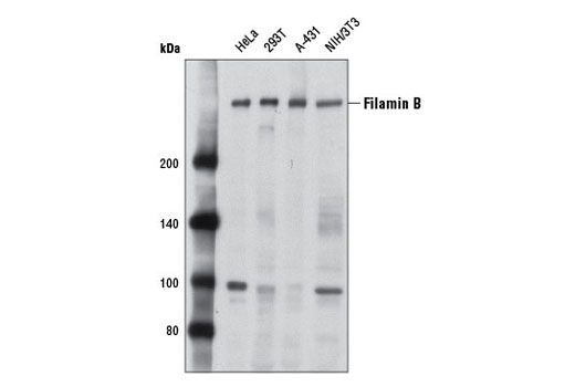Western Blotting Image 1: Filamin B Antibody