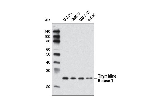 Western Blotting Image 1: Thymidine Kinase 1 Antibody