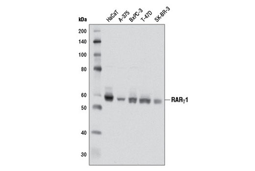  Image 6: Retinoic Acid and Retinoid X Receptors Antibody Sampler Kit