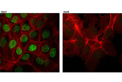 Immunofluorescence Image 1: RARγ1 (D3A4) XP® Rabbit mAb