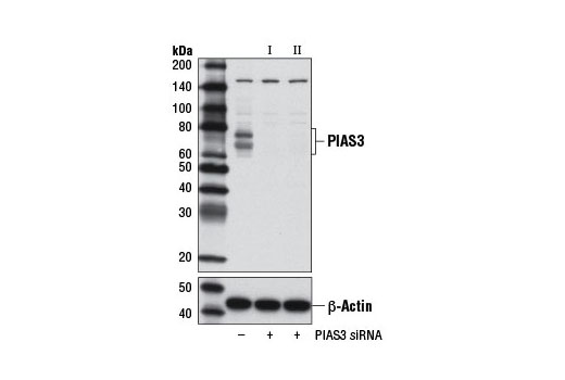  Image 1: SignalSilence® PIAS3 siRNA II