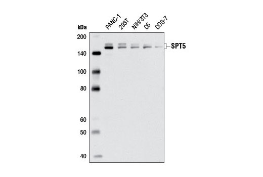 Western Blotting Image 1: SPT5 Antibody
