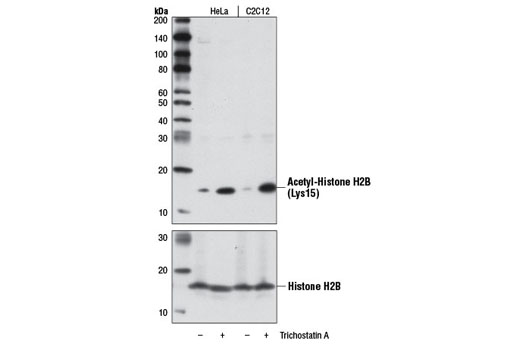 Western Blotting Image 1: Acetyl-Histone H2B (Lys15) (D8H1) XP® Rabbit mAb