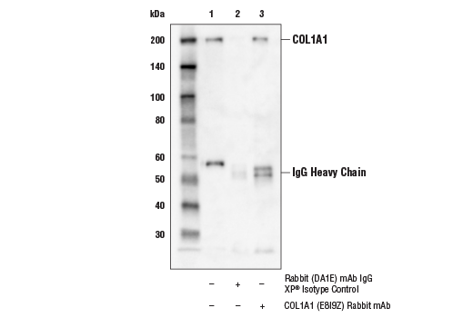  Image 23: TGF-β Fibrosis Pathway Antibody Sampler Kit