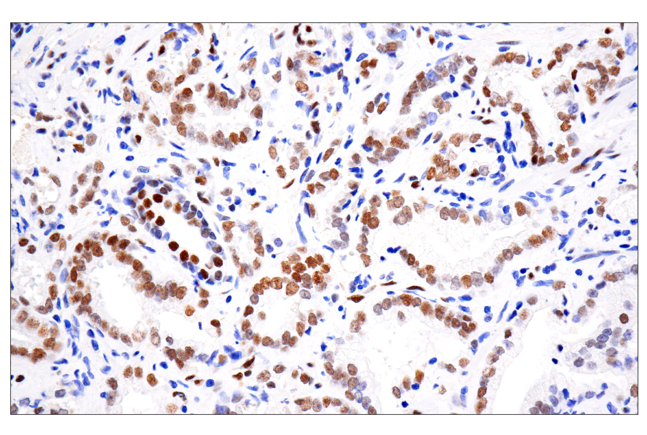  Image 8: PhosphoPlus® Stat3 (Tyr705) Antibody Duet