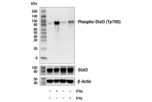  Image 2: Phospho-Stat Antibody Sampler Kit