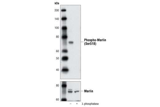 Western Blotting Image 1: Phospho-Merlin (Ser518) Antibody