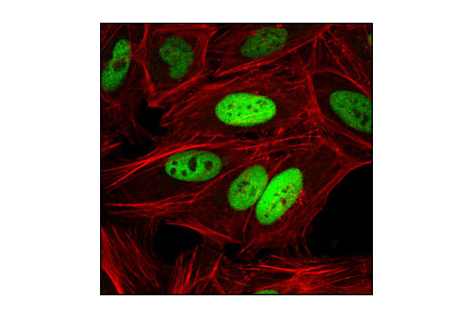 Image 13: PhosphoPlus® c-Jun (Ser63) Antibody Duet