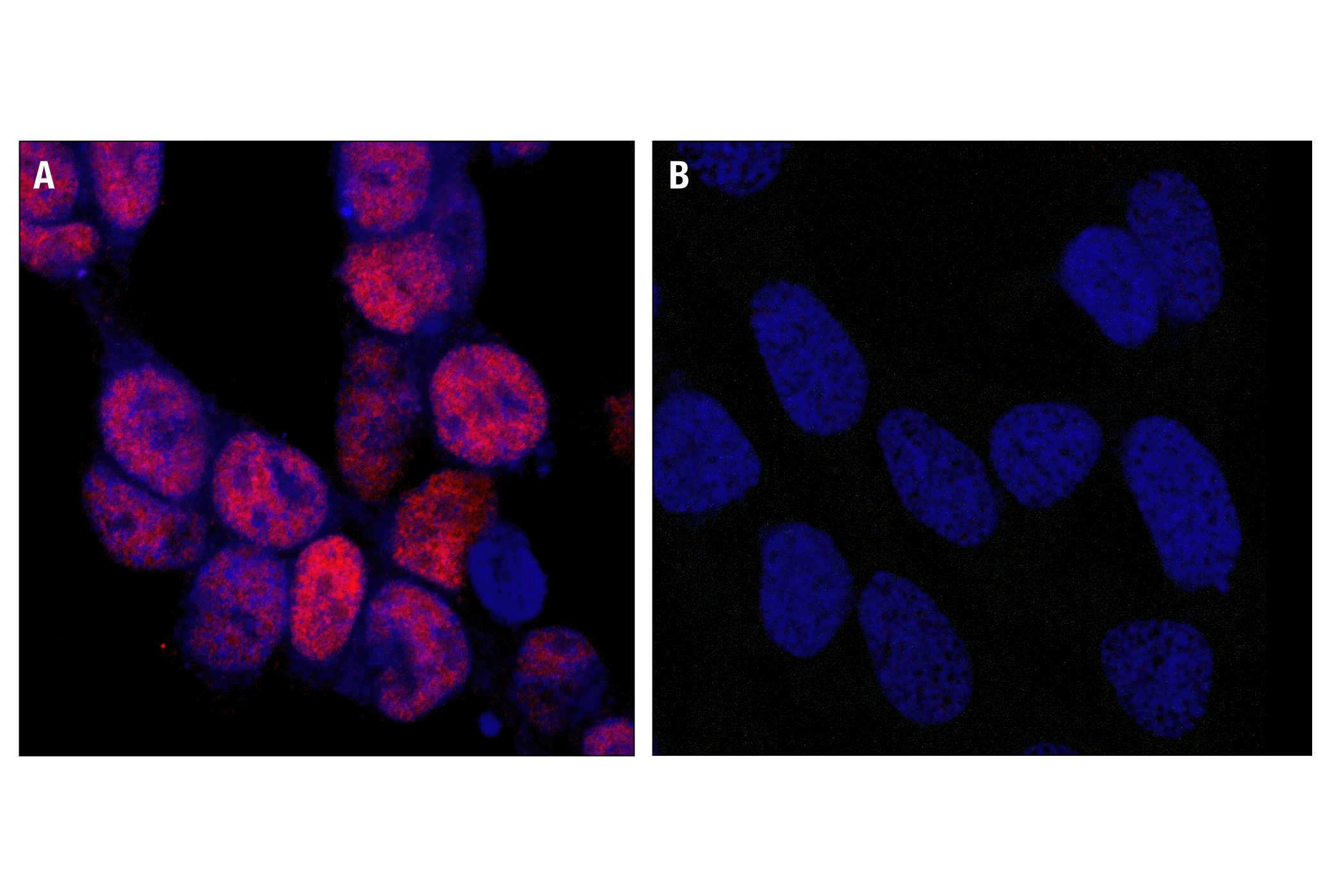  Image 18: PhosphoPlus® CREB (Ser133) Antibody Duet