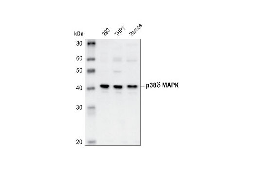 Western Blotting Image 1: p38δ MAPK Antibody