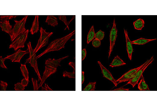 Immunofluorescence Image 1: Phospho-ATF-2 (Thr71) Antibody