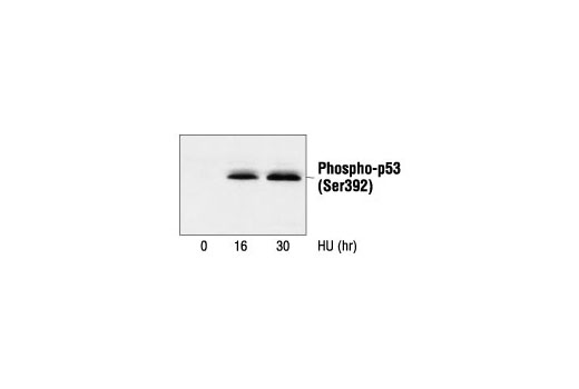 Western Blotting Image 2: Phospho-p53 (Ser392) Antibody