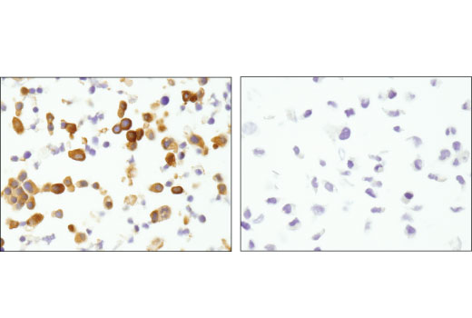 Immunohistochemistry Image 3: MTSS1 (D2H4L) XP® Rabbit mAb