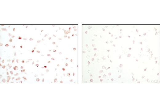 Immunohistochemistry Image 2: Phospho-Stat5 (Tyr694) (C71E5) Rabbit mAb