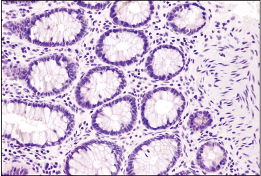 Immunohistochemistry Image 1: Tyrosinase (T311) Mouse mAb (IHC Specific)