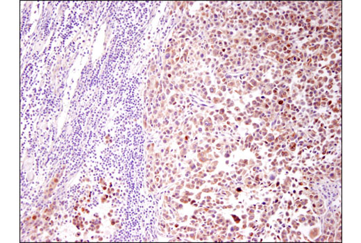 Immunohistochemistry Image 2: Tyrosinase (T311) Mouse mAb (IHC Specific)
