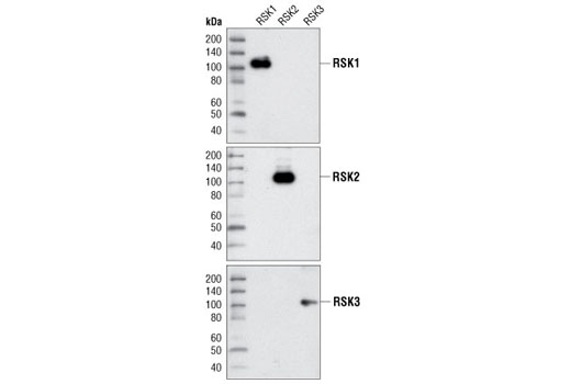 Western Blotting Image 1: RSK1 Antibody