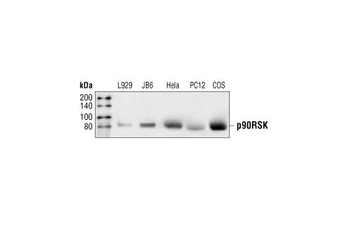 Western Blotting Image 1: RSK1/RSK2/RSK3 Antibody
