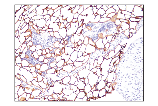  Image 18: Lipolysis Activation Antibody Sampler Kit