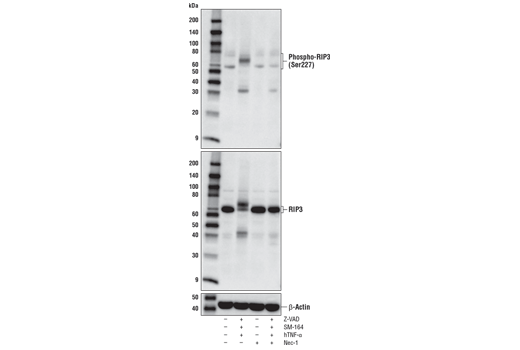  Image 12: Necroptosis Antibody Sampler Kit