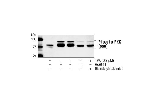 Western Blotting Image 2: Phospho-PKC (pan) (βII Ser660) Antibody