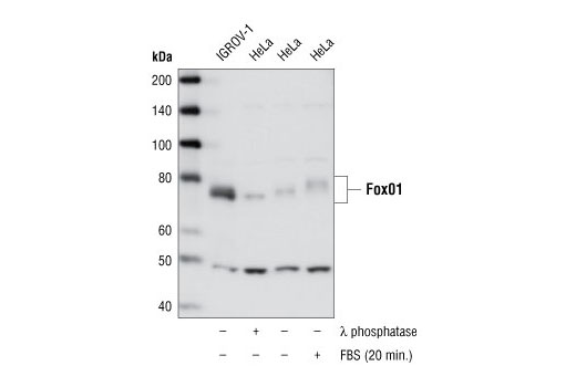 Western Blotting Image 1: FoxO1 (L27) Antibody