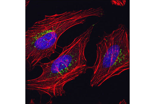 Immunofluorescence Image 1: RagC (D8H5) Rabbit mAb