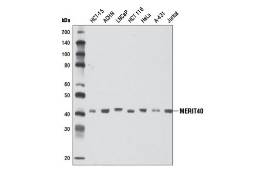 Western Blotting Image 1: MERIT40 Antibody