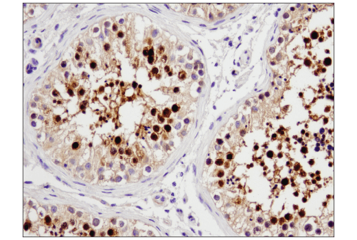 Immunohistochemistry Image 4: STK33 (D3S4R) Rabbit mAb