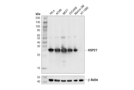  Image 3: PhosphoPlus® HSP27 (Ser82) Antibody Duet