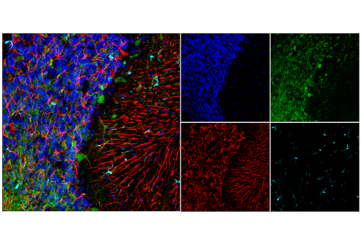 GFAP E8S7G Mouse MAb Cell Signaling Technology