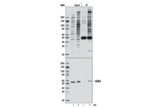 Immunoprecipitation Image 1: Phospho-ATM/ATR Substrate (S*Q) (D23H2/D69H5) MultiMab®  Rabbit mAb mix