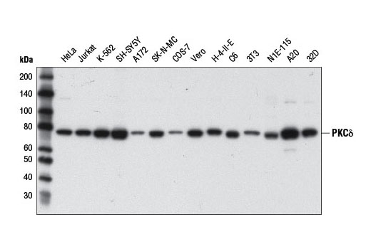  Image 8: PKC Isoform Antibody Sampler Kit