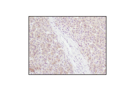 Immunohistochemistry Image 2: 4E-BP1 (53H11) Rabbit mAb