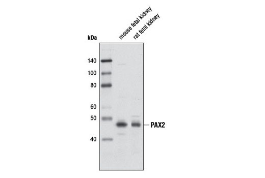 Western Blotting Image 1: PAX2 Antibody