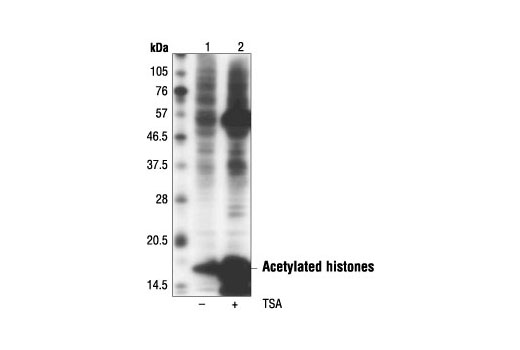 Western Blotting Image 1: Acetylated-Lysine Mouse mAb (Ac-K-103)