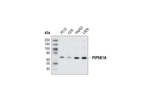 Western Blotting Image 1: PIP5K1A Antibody