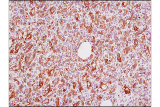 Immunohistochemistry Image 1: VEGF Receptor 2 (D5B1) Rabbit mAb
