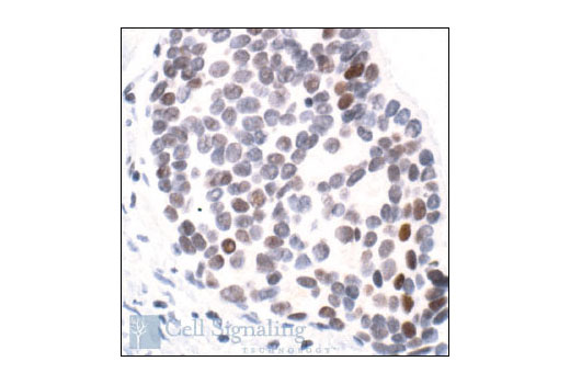Immunohistochemistry Image 1: Acetyl- and Phospho-Histone H3 (Lys9/Ser10) Antibody