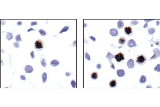 Image 17: Phospho-Histone H3 (Mitotic Marker) Antibody Sampler Kit